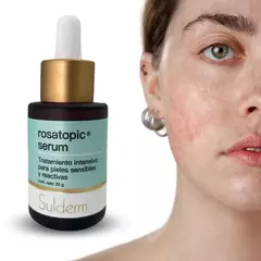 Sulderm Rosatopic Serum x30g