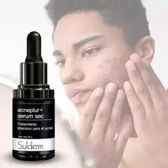 Sulderm Acneplur Serum Sec 30g